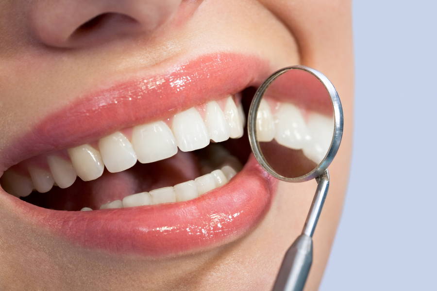 Ng&agrave;y nay, người ti&ecirc;u d&ugrave;ng sẵn s&agrave;ng chi trả những khoản tiền lớn để sở hữu nụ cười đều đẹp, tự nhi&ecirc;n